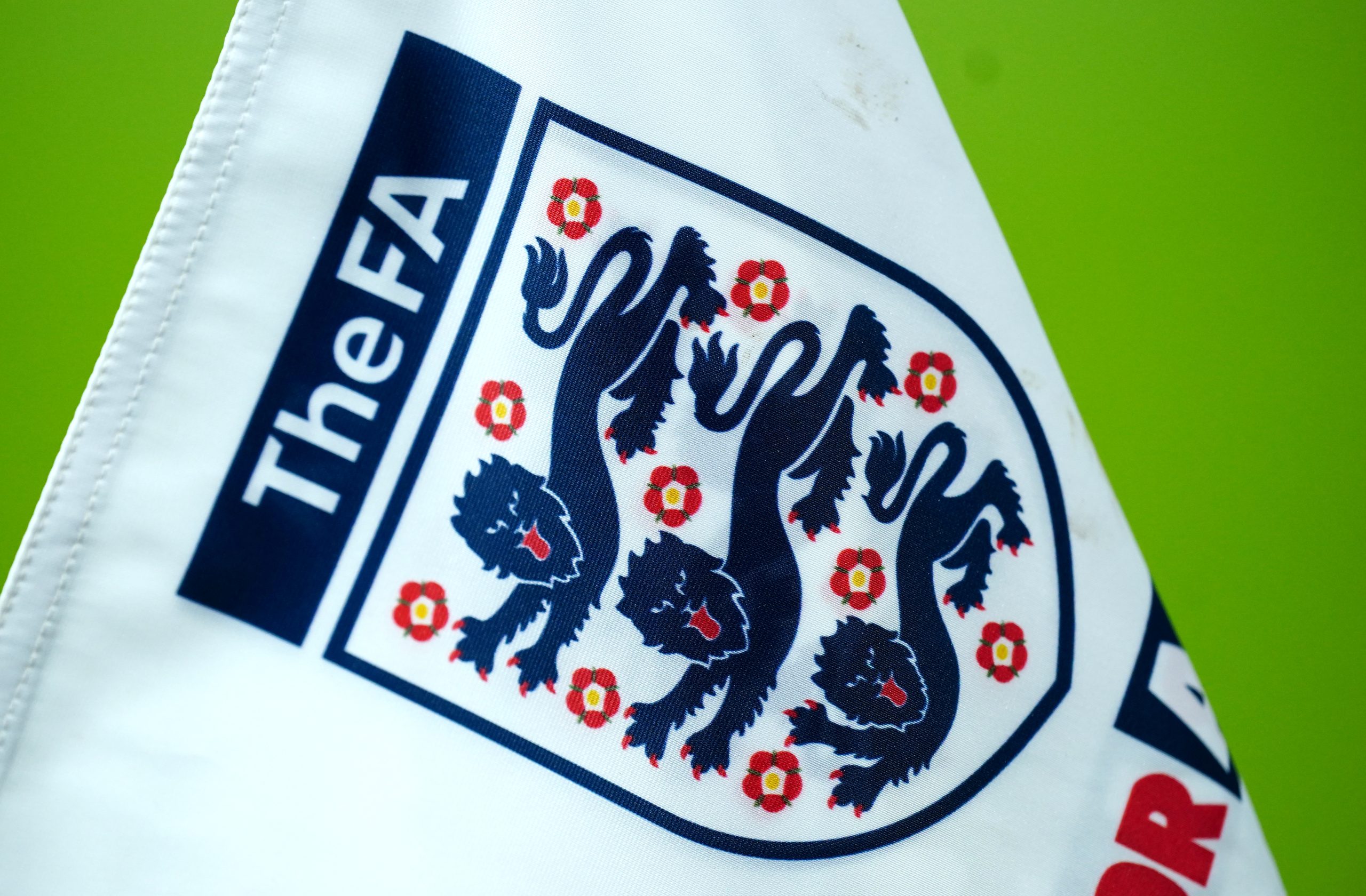 FA and PFA study finds increased dementia risk in ex-footballers